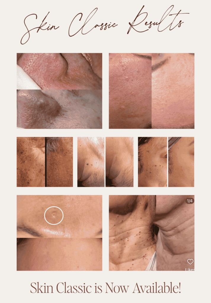 New at CREAM: Skin Classic New at CREAM: Skin Classic